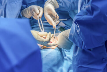 hernia